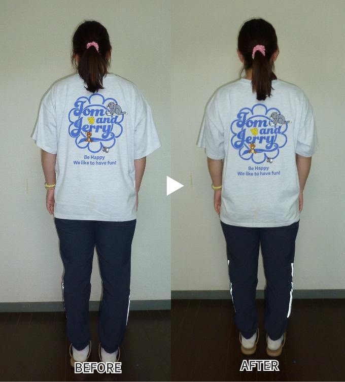 肩こりのBefore after